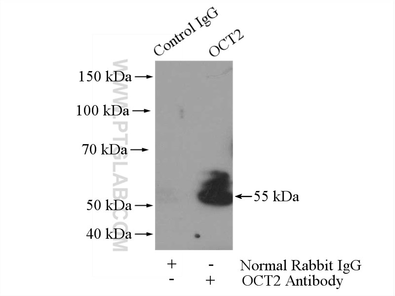 Immunoprecipitation (IP) experiment of NIH/3T3 cells using OCT2 Polyclonal antibody (10867-2-AP)
