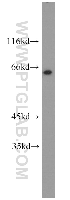 Western Blot (WB) analysis of NIH/3T3 cells using OCT2 Polyclonal antibody (10867-2-AP)