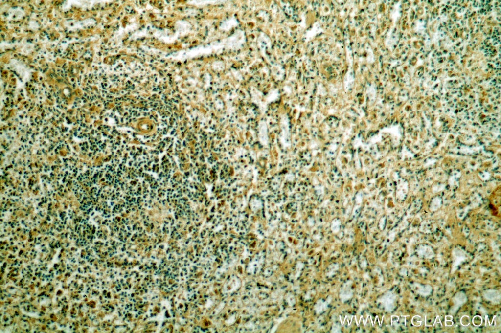 Immunohistochemistry (IHC) staining of human spleen tissue using OCT2-Specific Polyclonal antibody (18996-1-AP)