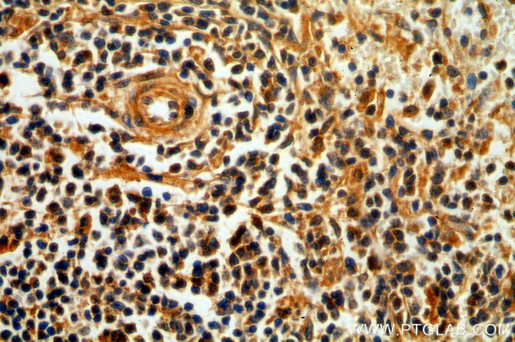 Immunohistochemistry (IHC) staining of human spleen tissue using OCT2-Specific Polyclonal antibody (18996-1-AP)