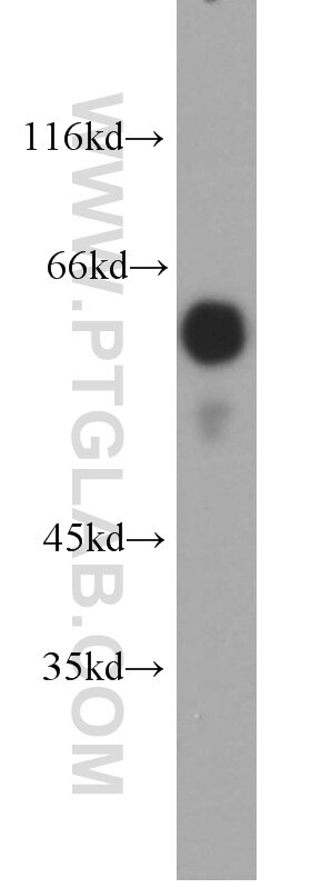 Western Blot (WB) analysis of Raji cells using OCT2-Specific Polyclonal antibody (18996-1-AP)
