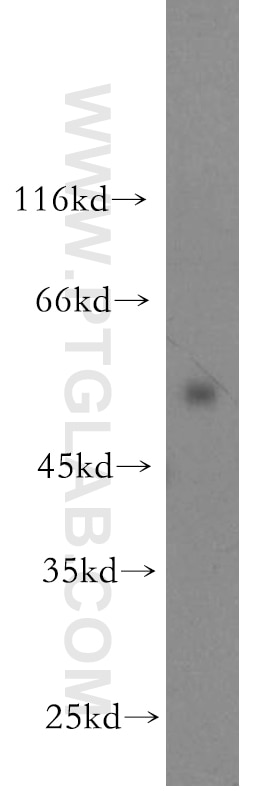 Western Blot (WB) analysis of human brain tissue using OCT2-Specific Polyclonal antibody (18996-1-AP)