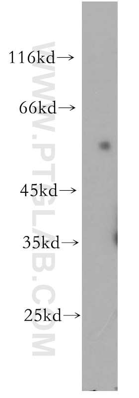 Western Blot (WB) analysis of human spleen tissue using OCT2-Specific Polyclonal antibody (18996-1-AP)