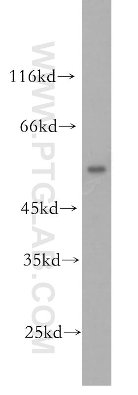 Western Blot (WB) analysis of mouse thymus tissue using OCT2-Specific Polyclonal antibody (18996-1-AP)