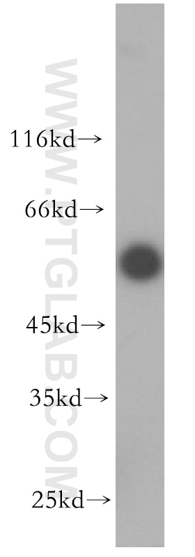 Western Blot (WB) analysis of mouse kidney tissue using OCT2-Specific Polyclonal antibody (18996-1-AP)