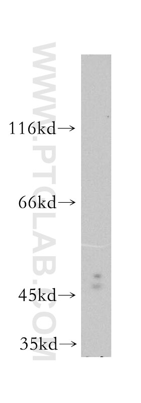 Western Blot (WB) analysis of HEK-293 cells using Oct6-Specific Polyclonal antibody (18997-1-AP)