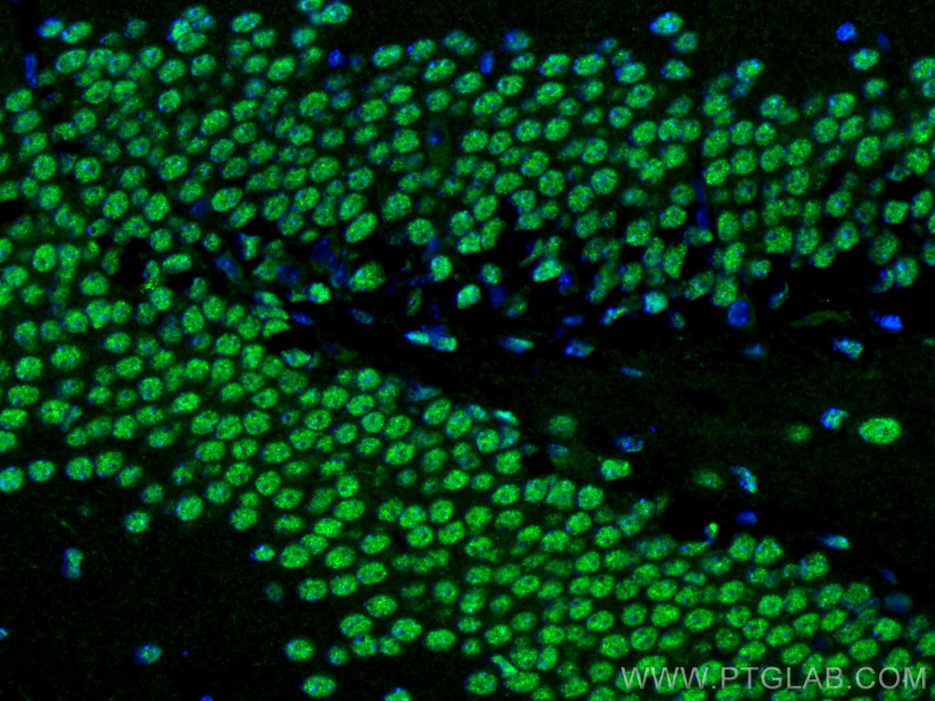 Immunofluorescence (IF) / fluorescent staining of mouse brain tissue using BRN2 Polyclonal antibody (14596-1-AP)