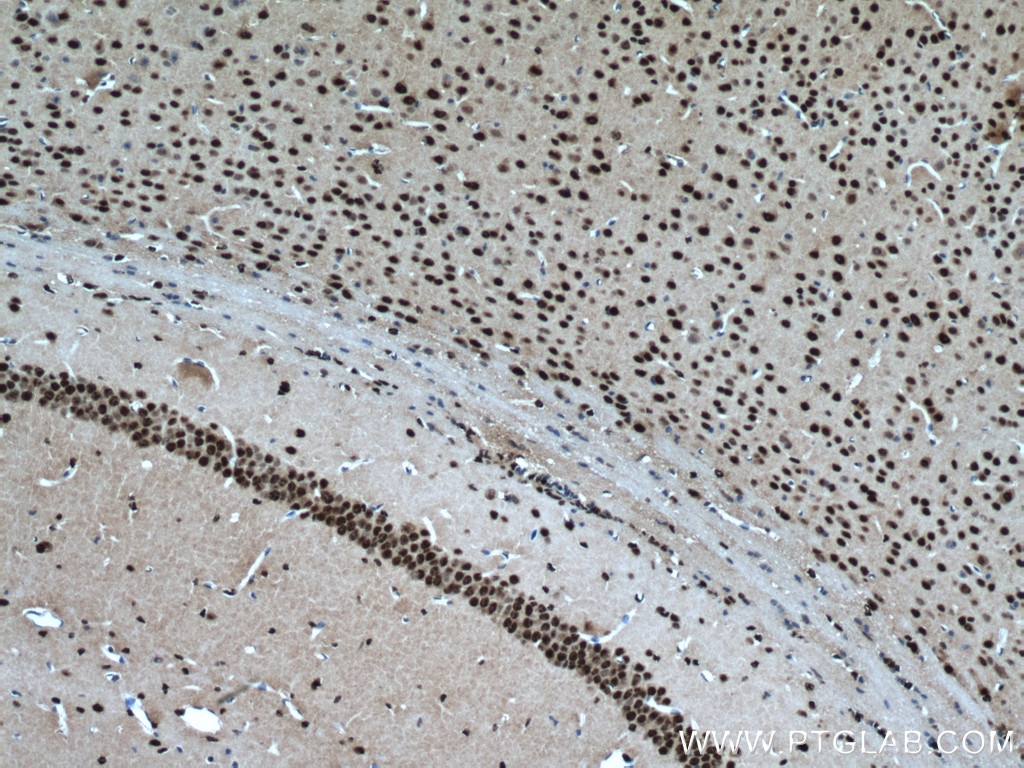 Immunohistochemistry (IHC) staining of mouse brain tissue using BRN2 Polyclonal antibody (14596-1-AP)