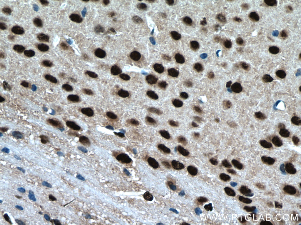 Immunohistochemistry (IHC) staining of mouse brain tissue using BRN2 Polyclonal antibody (14596-1-AP)