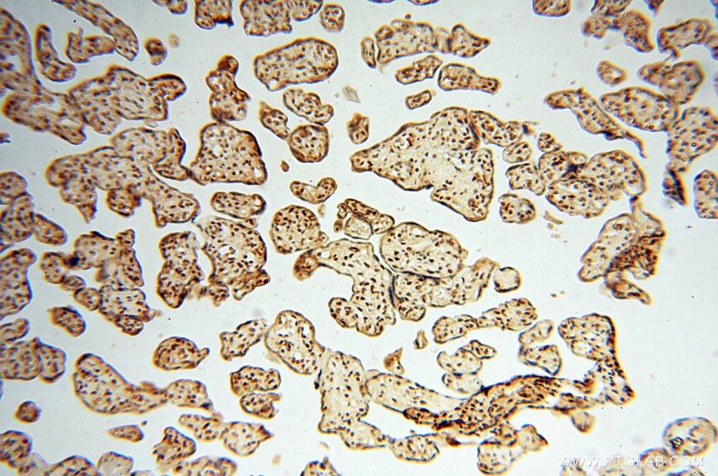 Immunohistochemistry (IHC) staining of human placenta tissue using BRN2 Polyclonal antibody (14596-1-AP)