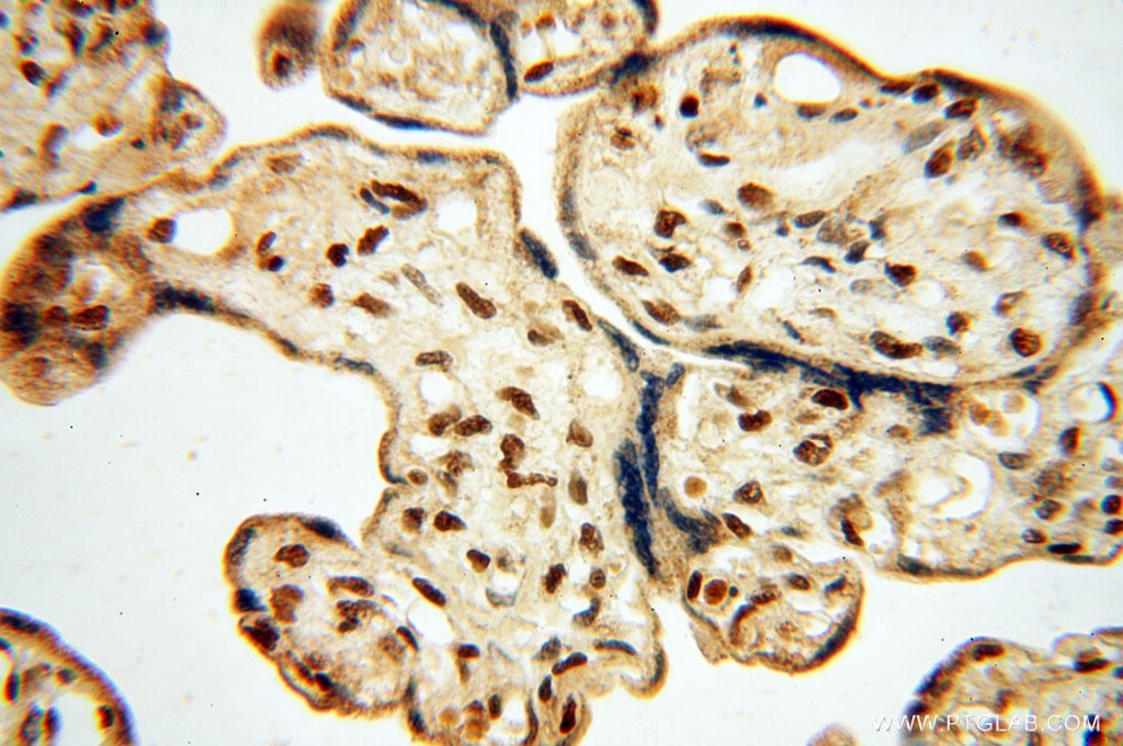 Immunohistochemistry (IHC) staining of human placenta tissue using BRN2 Polyclonal antibody (14596-1-AP)