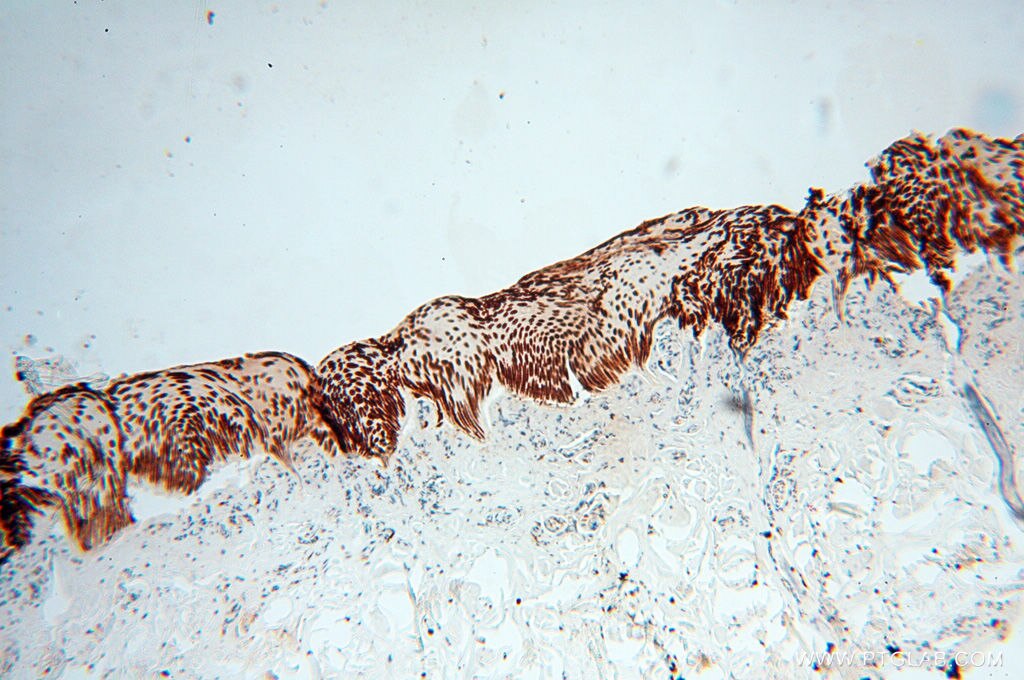 IHC staining of human skin using 14596-1-AP