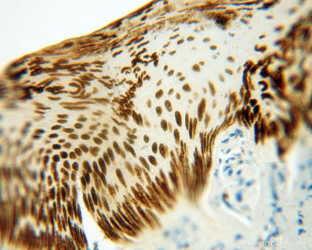 IHC staining of human skin using 14596-1-AP