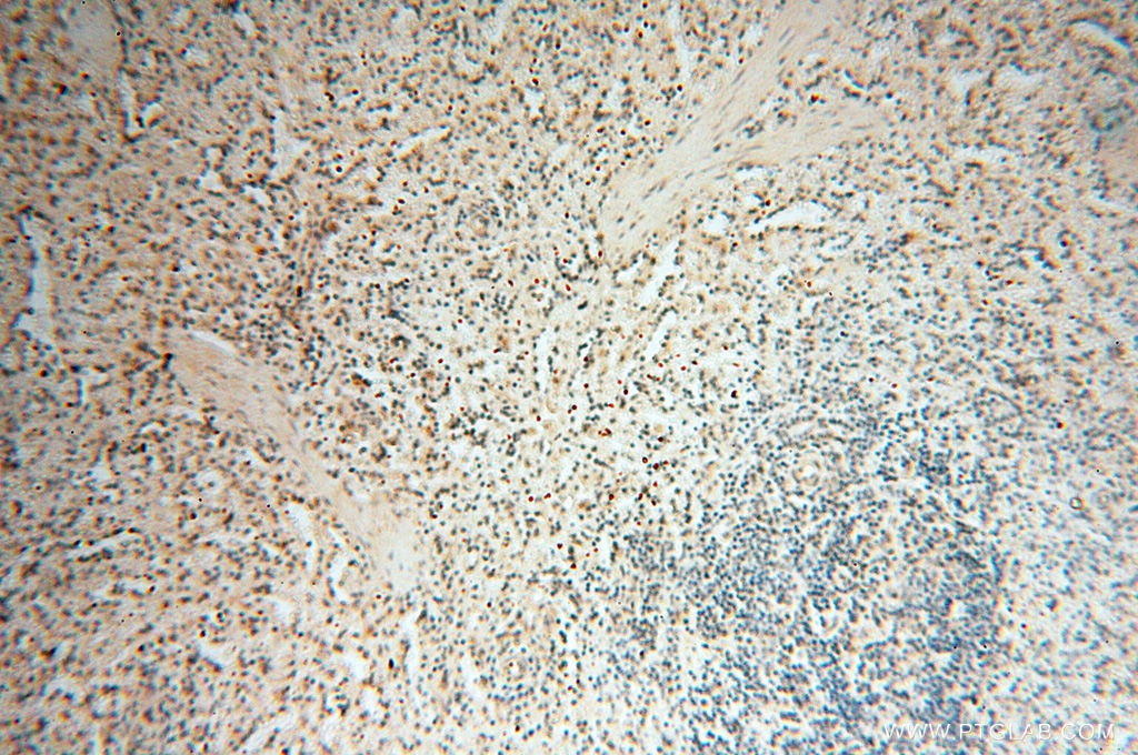 Immunohistochemistry (IHC) staining of human spleen tissue using BRN2 Polyclonal antibody (14596-1-AP)