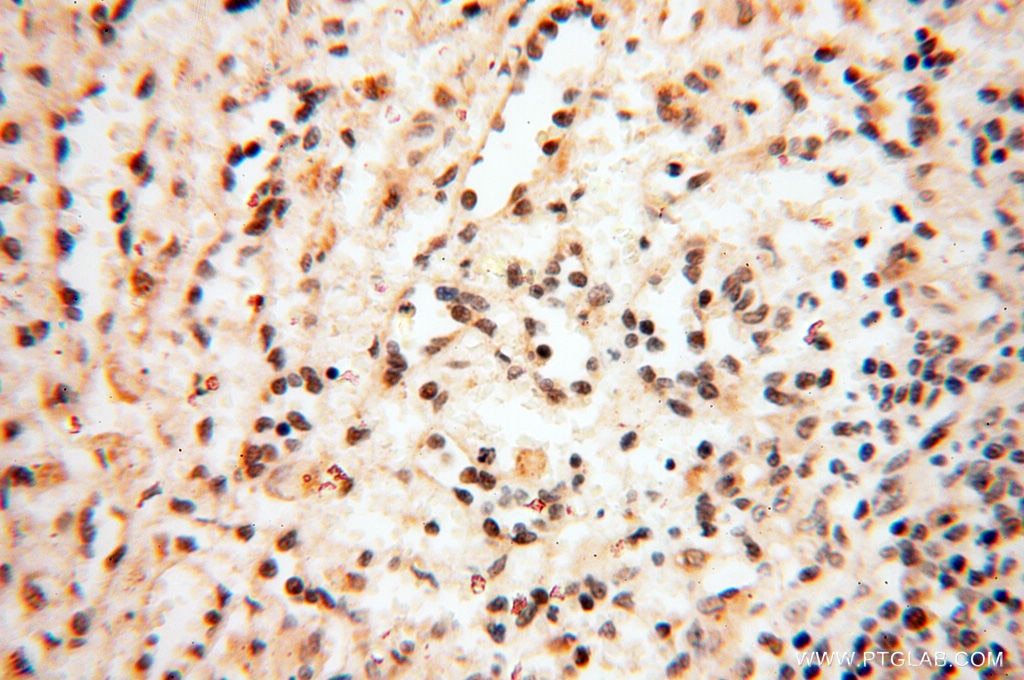 Immunohistochemistry (IHC) staining of human spleen tissue using BRN2 Polyclonal antibody (14596-1-AP)