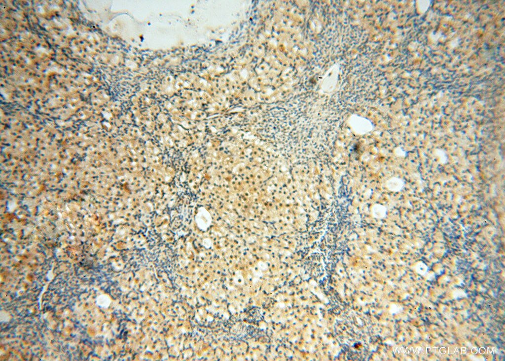 Immunohistochemistry (IHC) staining of human ovary tissue using BRN2 Polyclonal antibody (14596-1-AP)