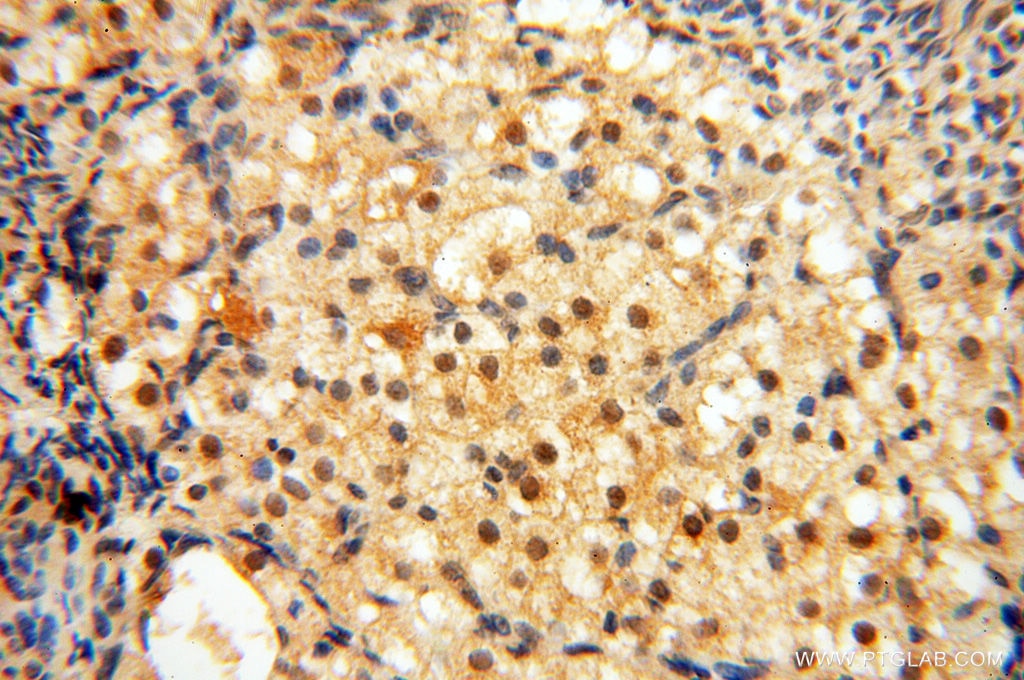 Immunohistochemistry (IHC) staining of human ovary tissue using BRN2 Polyclonal antibody (14596-1-AP)