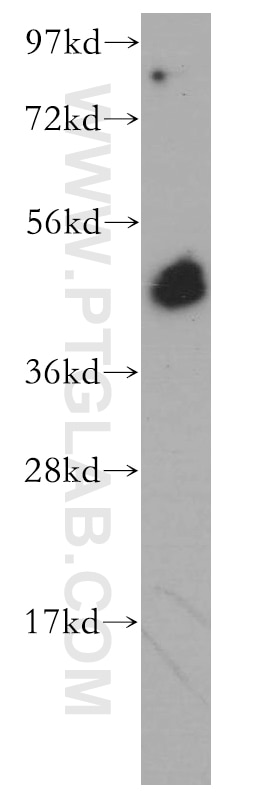 Western Blot (WB) analysis of Jurkat cells using BRN2 Polyclonal antibody (14596-1-AP)