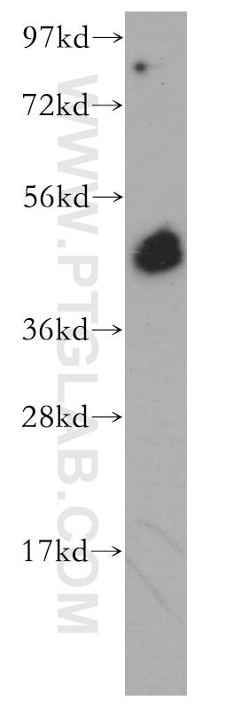 WB analysis of Jurkat using 14596-1-AP
