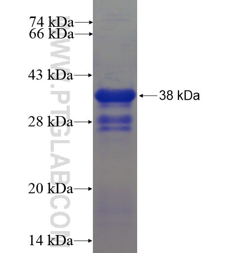 POU3F2 fusion protein Ag6140 SDS-PAGE