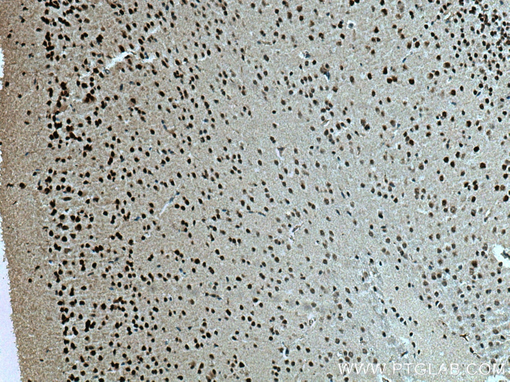 IHC staining of mouse brain using 18998-1-AP