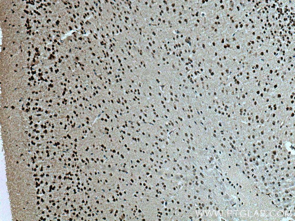 Immunohistochemistry (IHC) staining of mouse brain tissue using BRN2-Specific Polyclonal antibody (18998-1-AP)