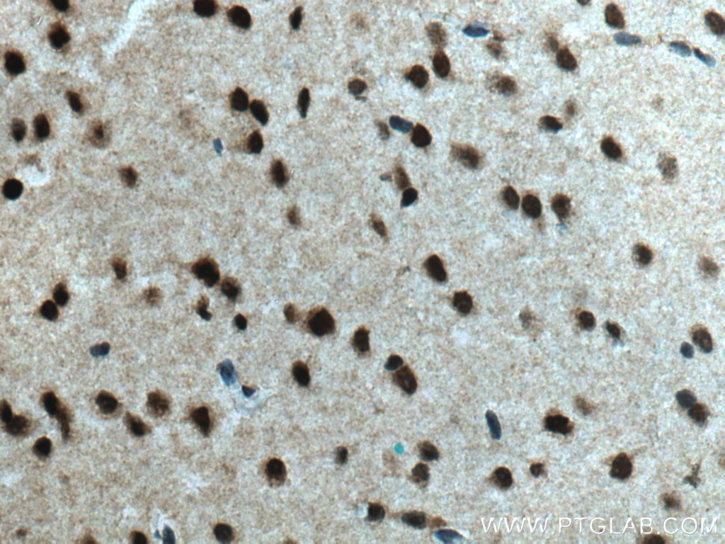 Immunohistochemistry (IHC) staining of mouse brain tissue using BRN2-Specific Polyclonal antibody (18998-1-AP)