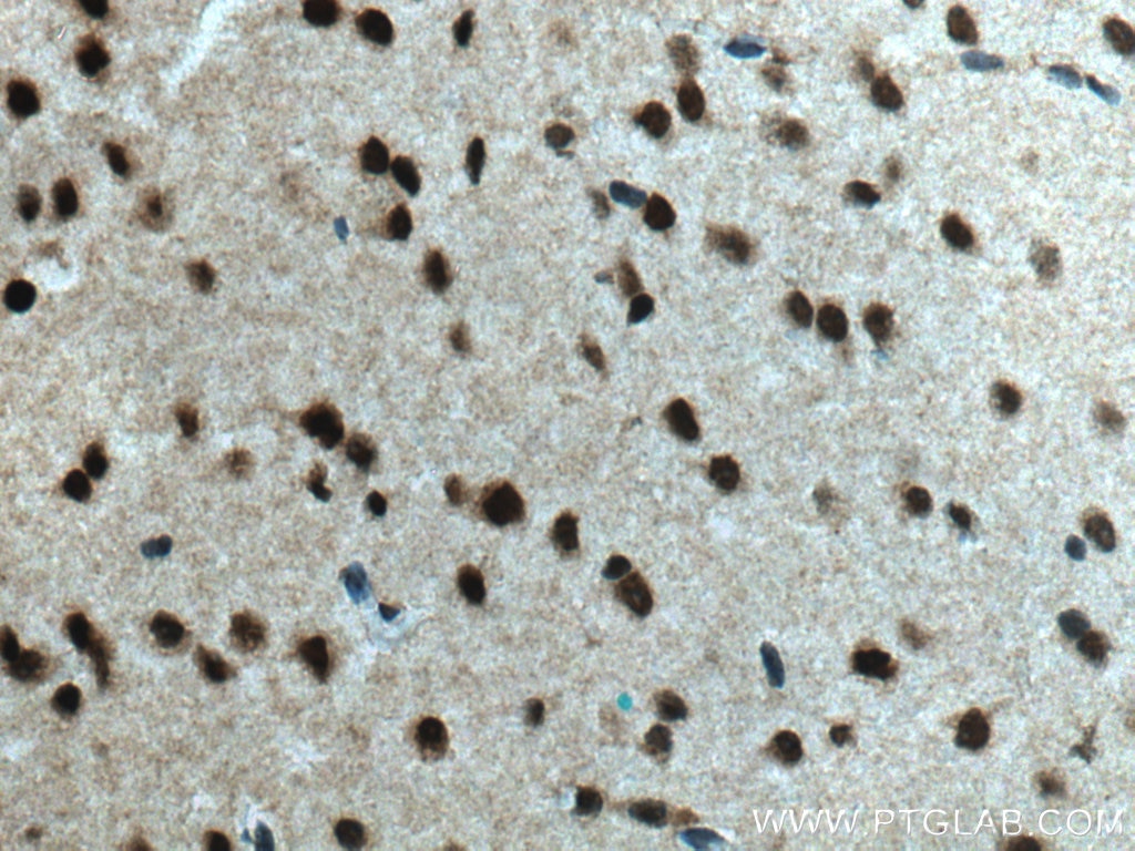 IHC staining of mouse brain using 18998-1-AP