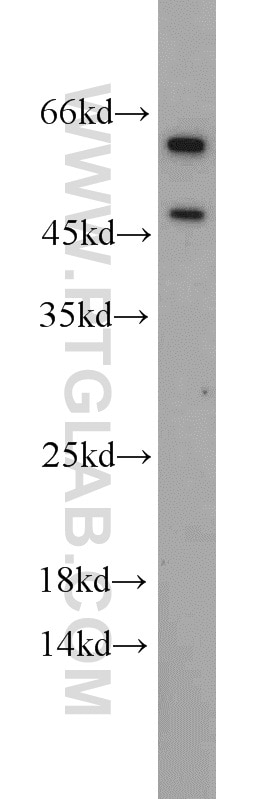 Western Blot (WB) analysis of A375 cells using BRN2-Specific Polyclonal antibody (18998-1-AP)
