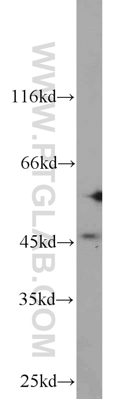 Western Blot (WB) analysis of HEK-293 cells using BRN2-Specific Polyclonal antibody (18998-1-AP)