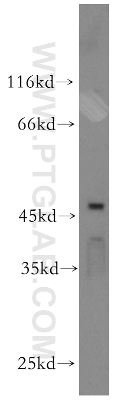Western Blot (WB) analysis of HeLa cells using BRN2-Specific Polyclonal antibody (18998-1-AP)