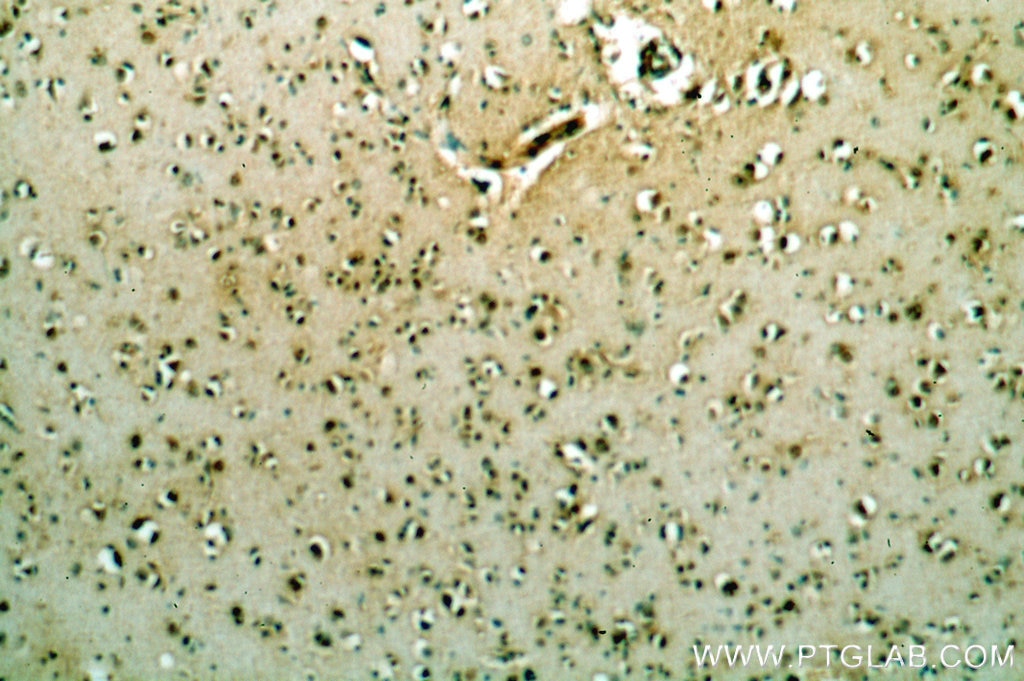 Immunohistochemistry (IHC) staining of human brain tissue using POU3F3-Specific Polyclonal antibody (18999-1-AP)