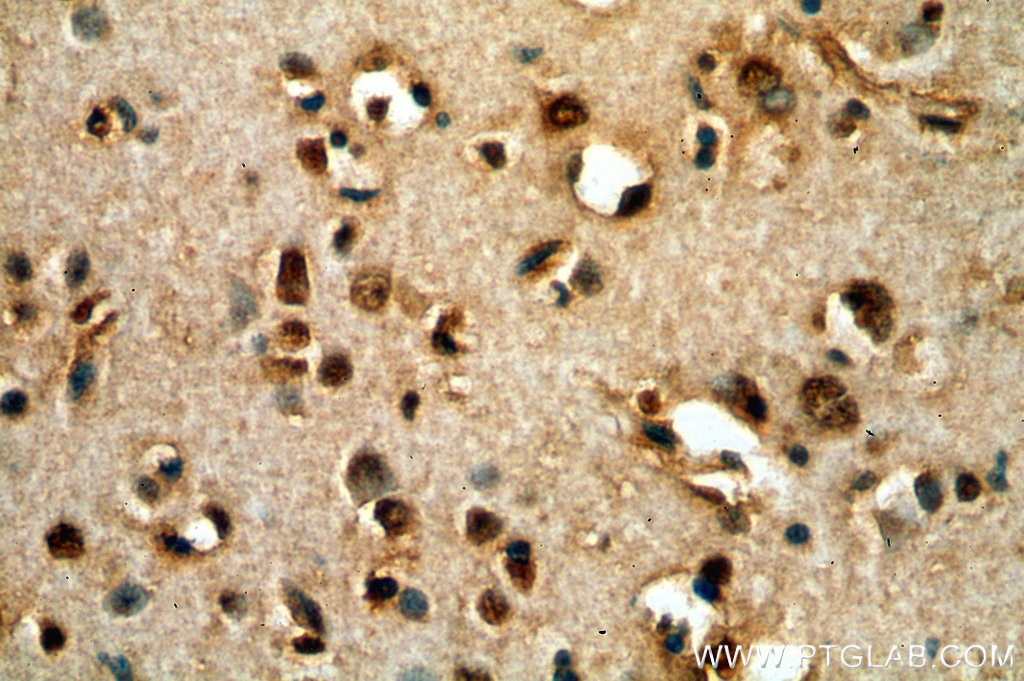 Immunohistochemistry (IHC) staining of human brain tissue using POU3F3-Specific Polyclonal antibody (18999-1-AP)
