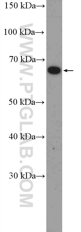 Western Blot (WB) analysis of SH-SY5Y cells using POU3F3-Specific Polyclonal antibody (18999-1-AP)