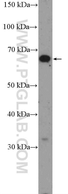 Western Blot (WB) analysis of SH-SY5Y cells using POU3F3-Specific Polyclonal antibody (18999-1-AP)