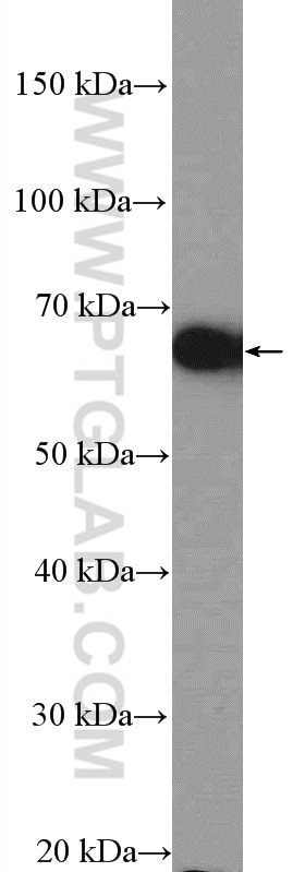 Western Blot (WB) analysis of mouse brain tissue using POU3F3-Specific Polyclonal antibody (18999-1-AP)