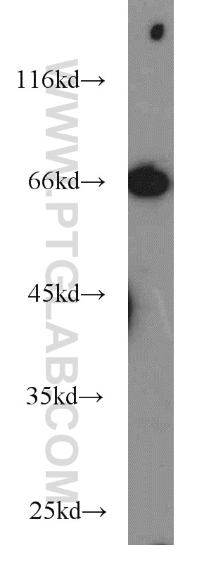 WB analysis of SH-SY5Y using 18999-1-AP