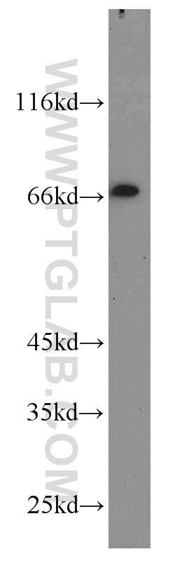 Western Blot (WB) analysis of SH-SY5Y cells using POU3F3-Specific Polyclonal antibody (18999-1-AP)