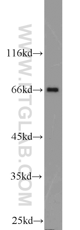 Western Blot (WB) analysis of HEK-293 cells using POU3F3-Specific Polyclonal antibody (18999-1-AP)