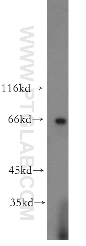 Western Blot (WB) analysis of human brain tissue using POU3F3-Specific Polyclonal antibody (18999-1-AP)