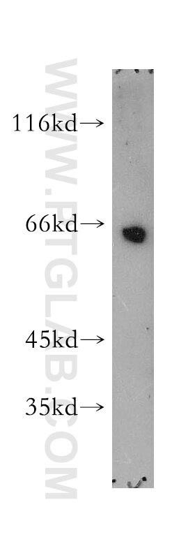 Western Blot (WB) analysis of mouse brain tissue using POU3F3-Specific Polyclonal antibody (18999-1-AP)
