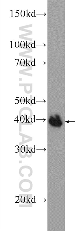 Western Blot (WB) analysis of fetal human brain tissue using POU3F4 Polyclonal antibody (25114-1-AP)