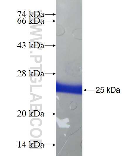 POU3F4 fusion protein Ag19020 SDS-PAGE
