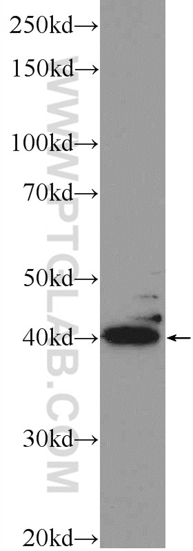 Western Blot (WB) analysis of mouse eye tissue using POU4F2 Polyclonal antibody (55042-1-AP)