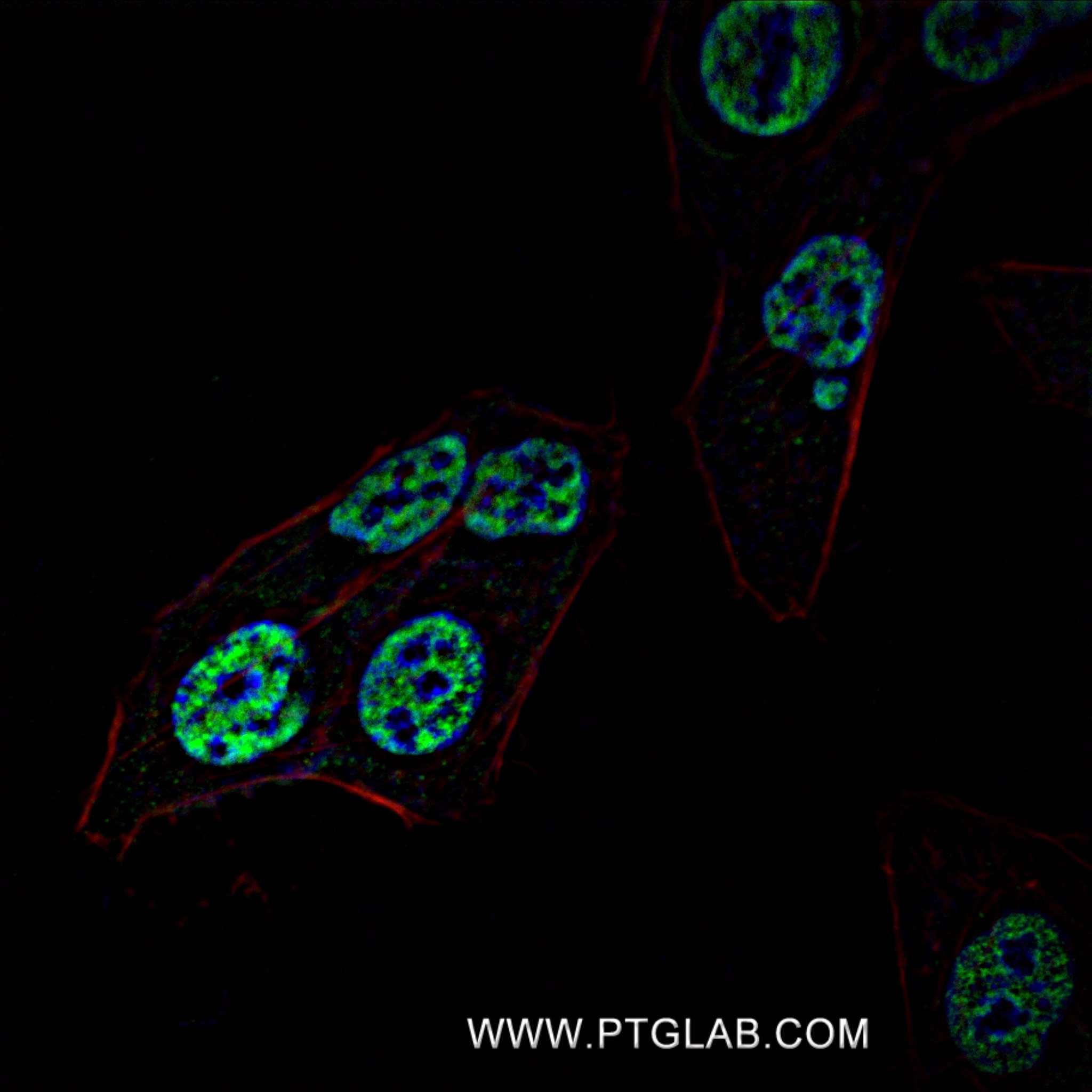Immunofluorescence (IF) / fluorescent staining of U2OS cells using POU4F3 Recombinant antibody (82980-1-RR)