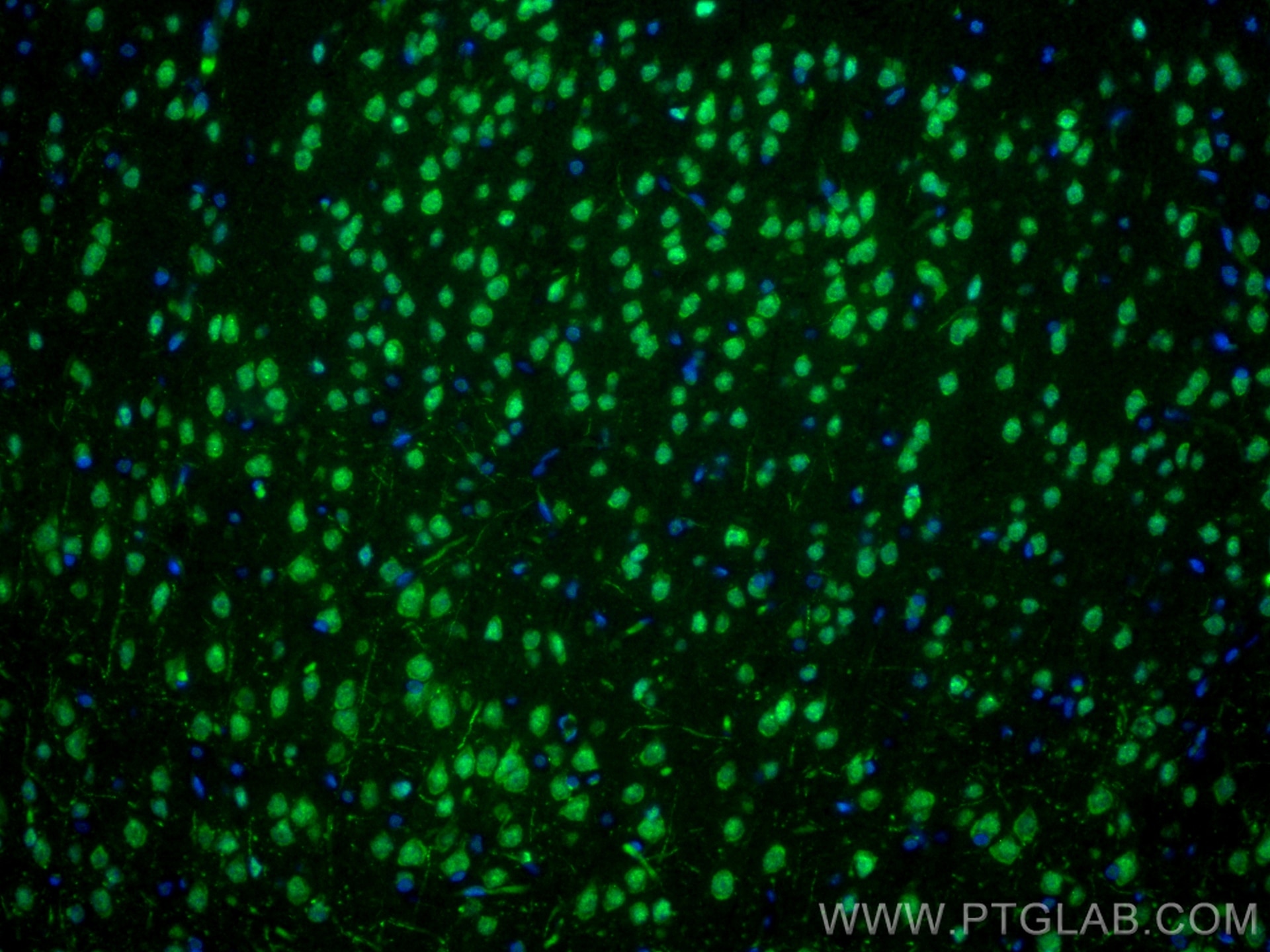Immunofluorescence (IF) / fluorescent staining of rat brain tissue using POU4F3 Recombinant antibody (82980-1-RR)