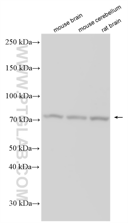 Various lysates were subjected to SDS PAGE followed by western blot with 33362-1-AP (POU6F2 antibody) at dilution of 1:1000 incubated at room temperature for 1.5 hours. Western Blot (WB) analysis of various lysates using POU6F2 Polyclonal antibody (33362-1-AP)