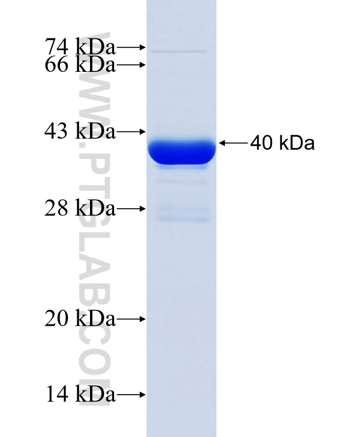 POU6F2 fusion protein Ag38018 SDS-PAGE POU6F2 fusion protein Ag38018 SDS-PAGE