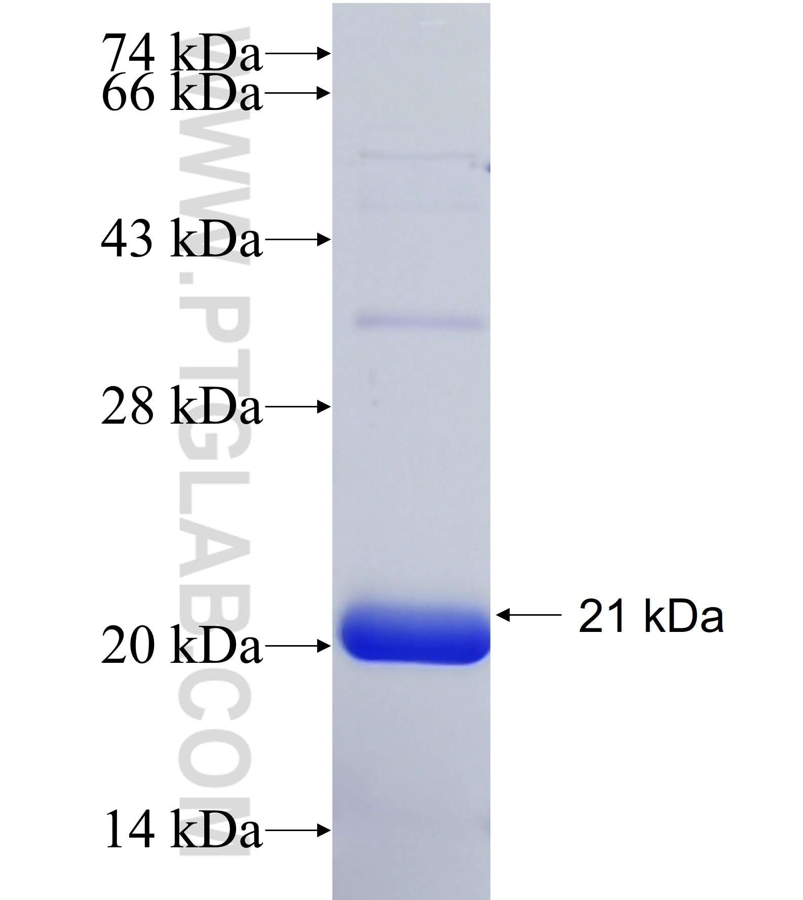 POU6F2 fusion protein Ag38031 SDS-PAGE POU6F2 fusion protein Ag38031 SDS-PAGE