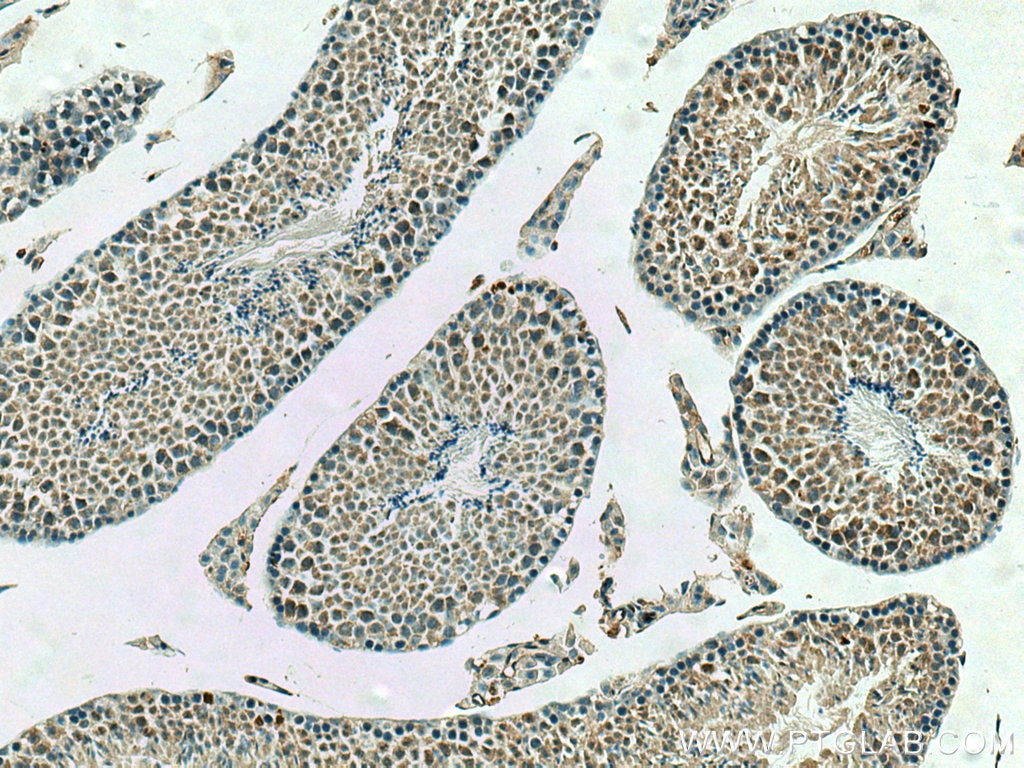 IHC staining of mouse testis using 10321-1-AP